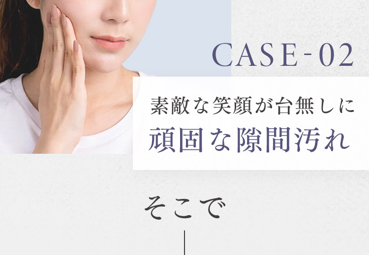 CASE-02 素敵な笑顔が台無しに 頑固な隙間汚れ