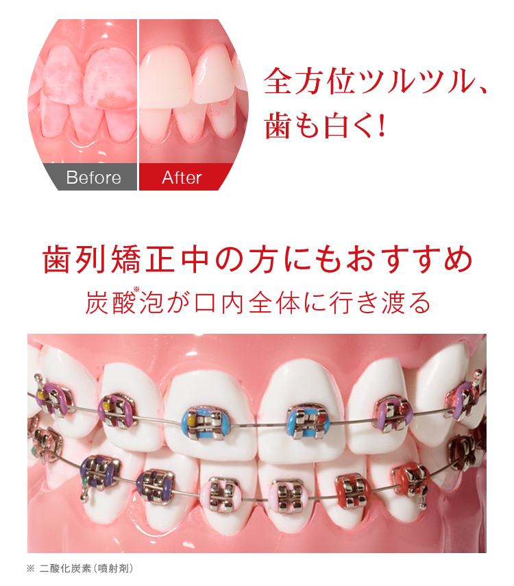全方位ツルツルに！歯列矯正中の方にもおすすめ！