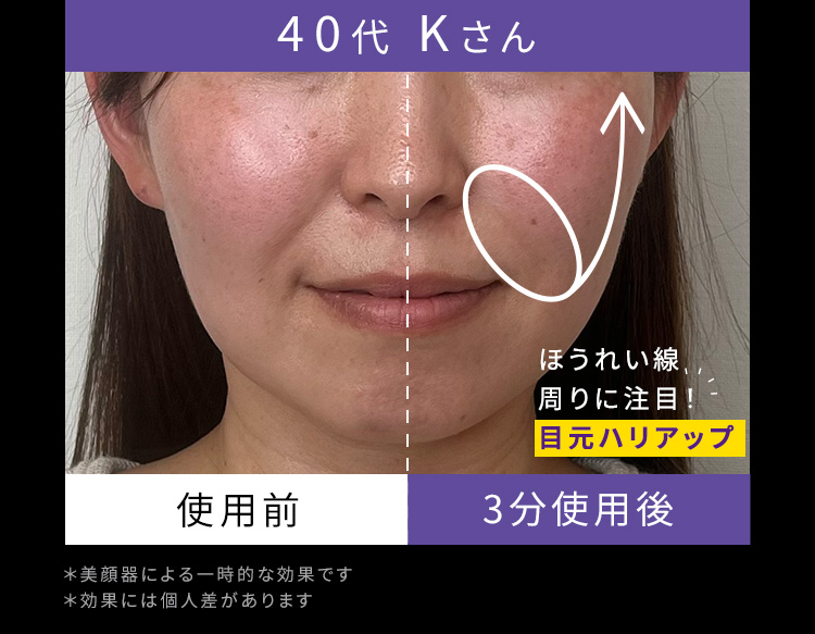 40代Kさん