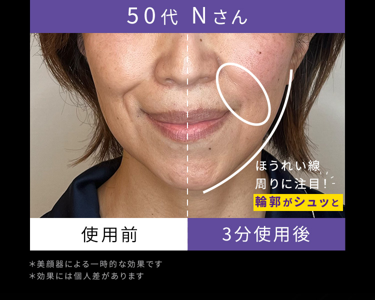 50代Nさん