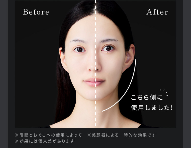 Before After