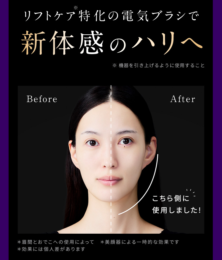 リフトケア特化の電気ブラシで新体感のハリへ