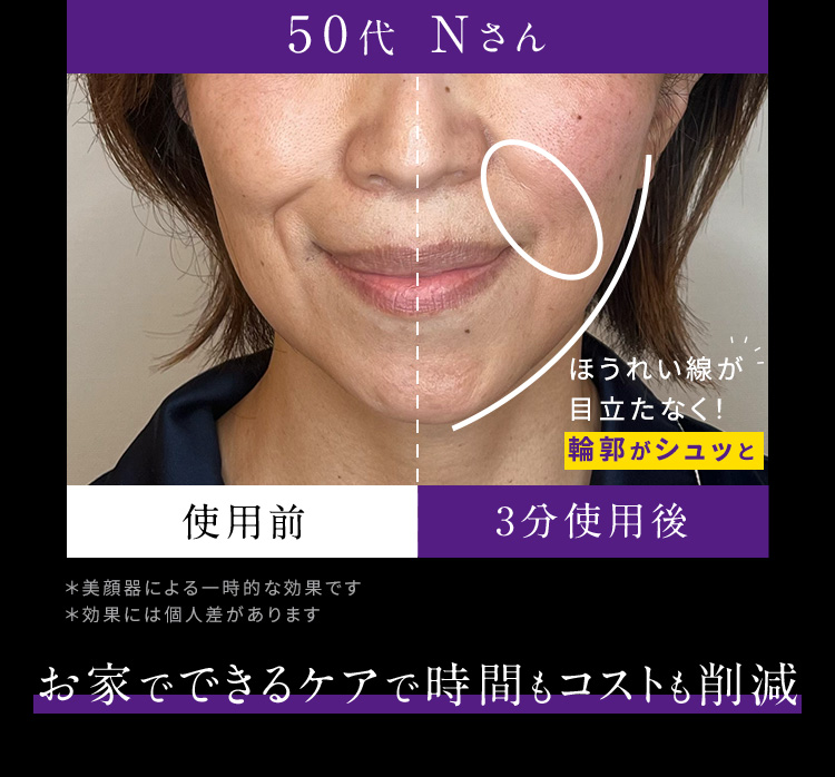 50代 Nさん