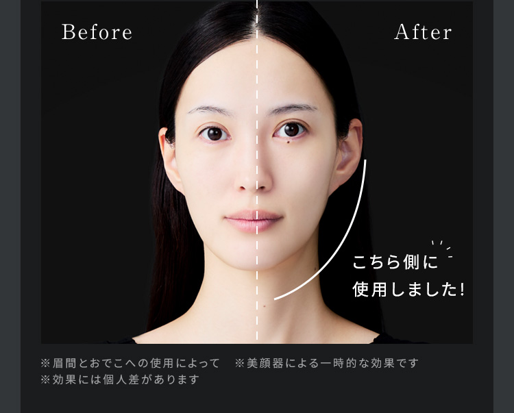 Before After こちら側に使用しました！