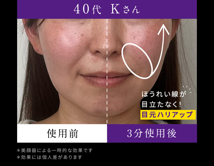 40代 Kさん
