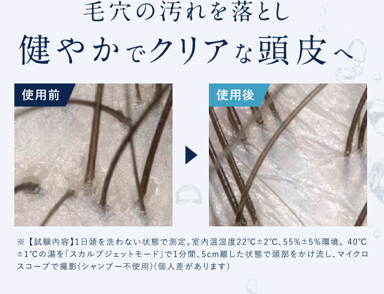 毛穴の汚れを落とし健やかでクリアな頭皮へ