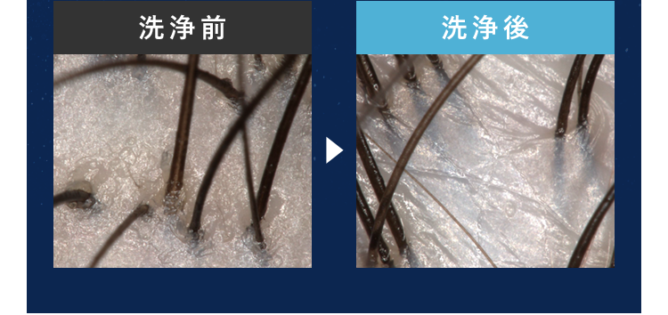 洗浄前洗浄後