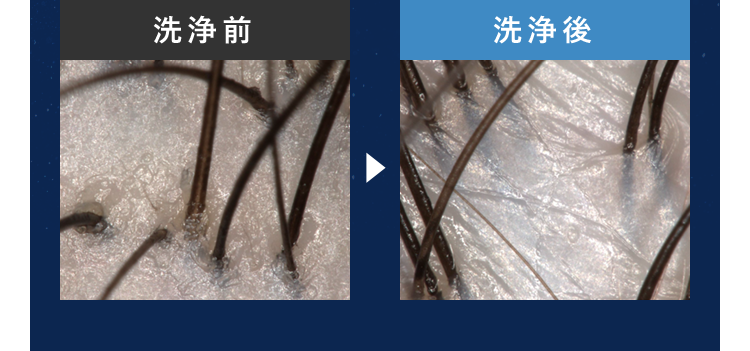 洗浄前洗浄後