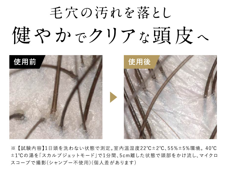 毛穴の汚れをお年健やかでクリアな頭皮へ