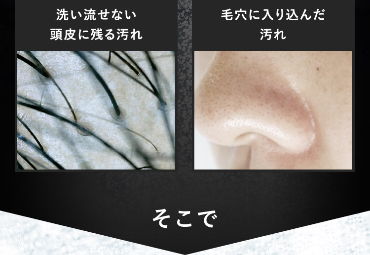 そこで