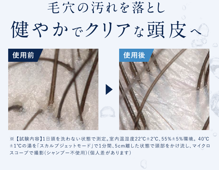 毛穴の汚れを落とし健やかでクリアな頭皮へ
